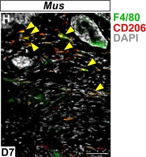 Detection of Mouse MMR/CD206/Mannose Receptor by Immunocytochemistry/Immunofluorescence