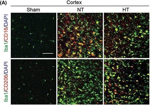 Detection of Mouse MMR/CD206/Mannose Receptor by Immunohistochemistry