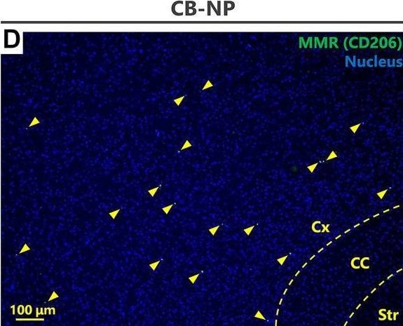 Detection of MMR/CD206 by Immunohistochemistry