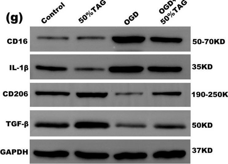 Detection of Mouse MMR/CD206 by Western Blot