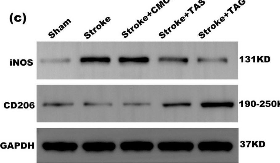 Detection of Mouse MMR/CD206 by Western Blot