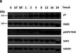 Detection of Human Human DDR2 Antibody by Western Blot