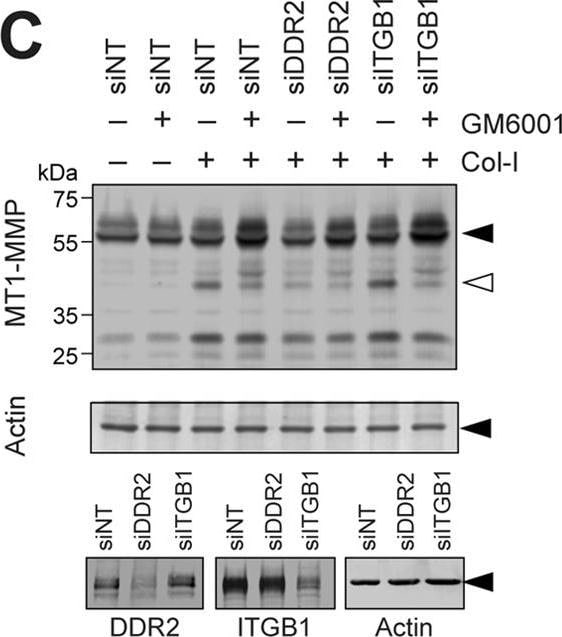 Detection of Human DDR2 by Knockdown Validated