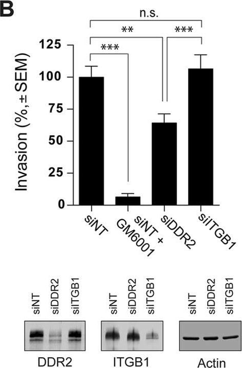 Detection of Human DDR2 by Knockdown Validated
