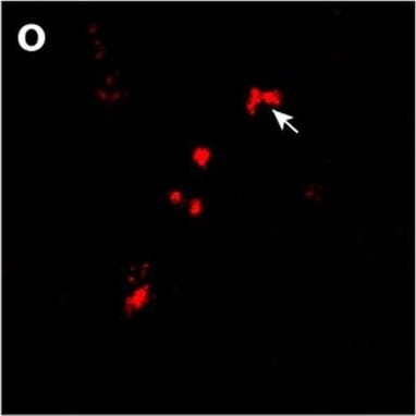 Detection of Human Osteoactivin/GPNMB by Immunohistochemistry