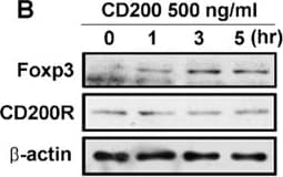Detection of CD200R1 by Western Blot