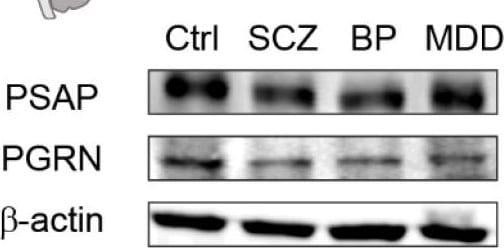 Detection of Human Mouse Progranulin/PGRN Antibody by Western Blot