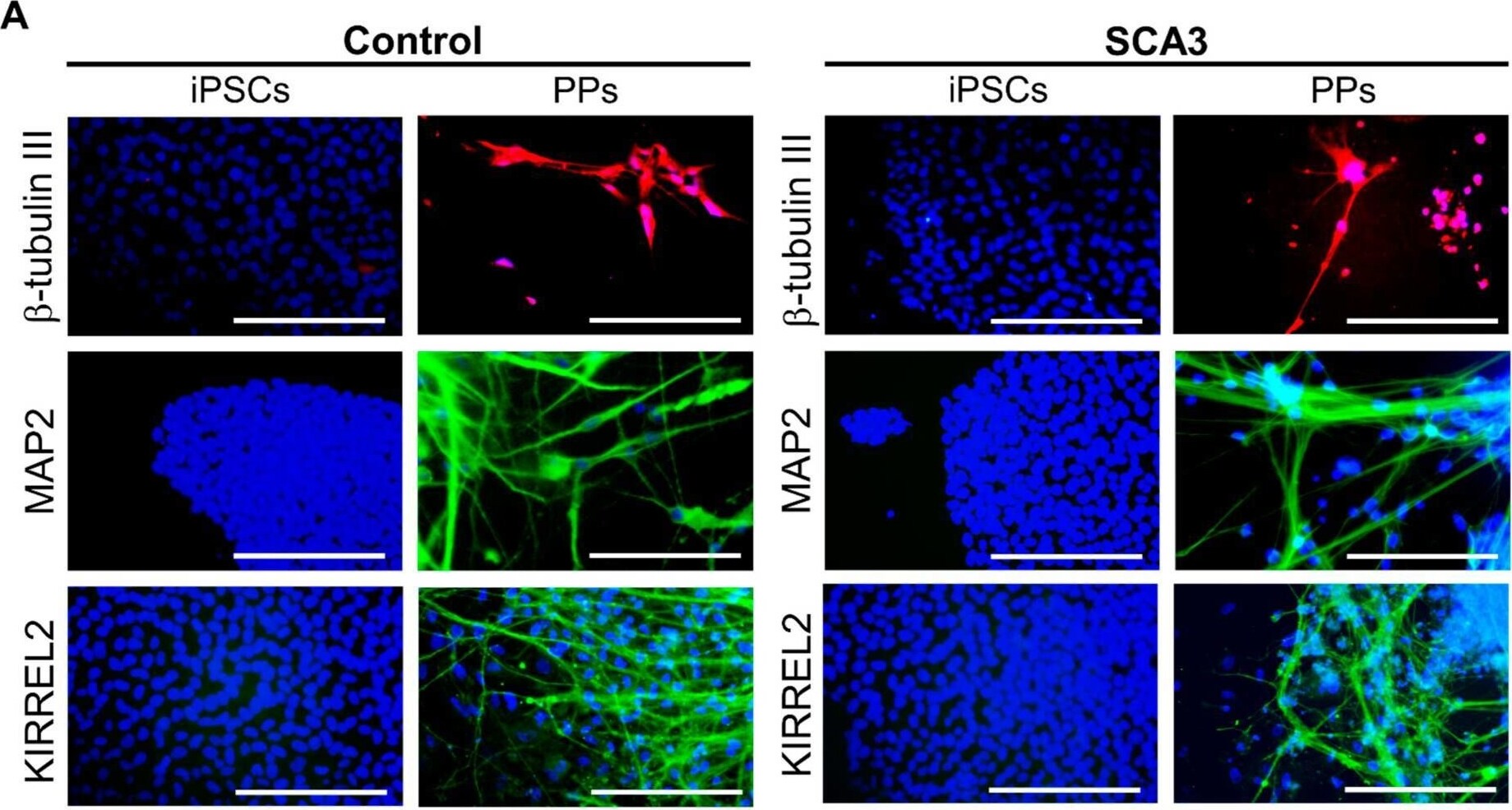 Detection of Kirrel2/NEPH3 by Immunocytochemistry/ Immunofluorescence