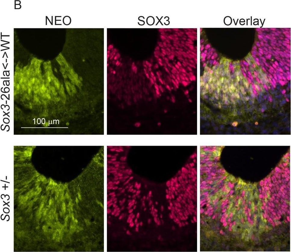 Detection of SOX3 by Immunohistochemistry