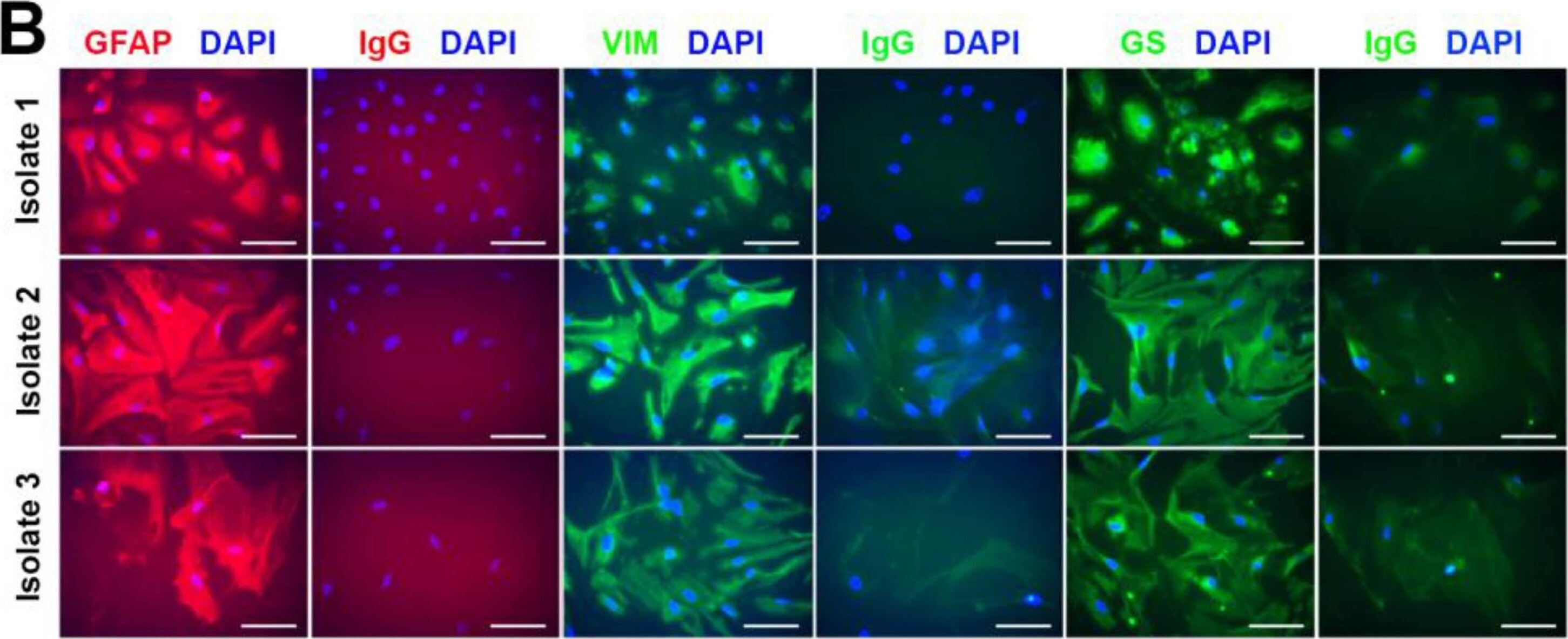 Detection of GFAP by Immunocytochemistry/ Immunofluorescence