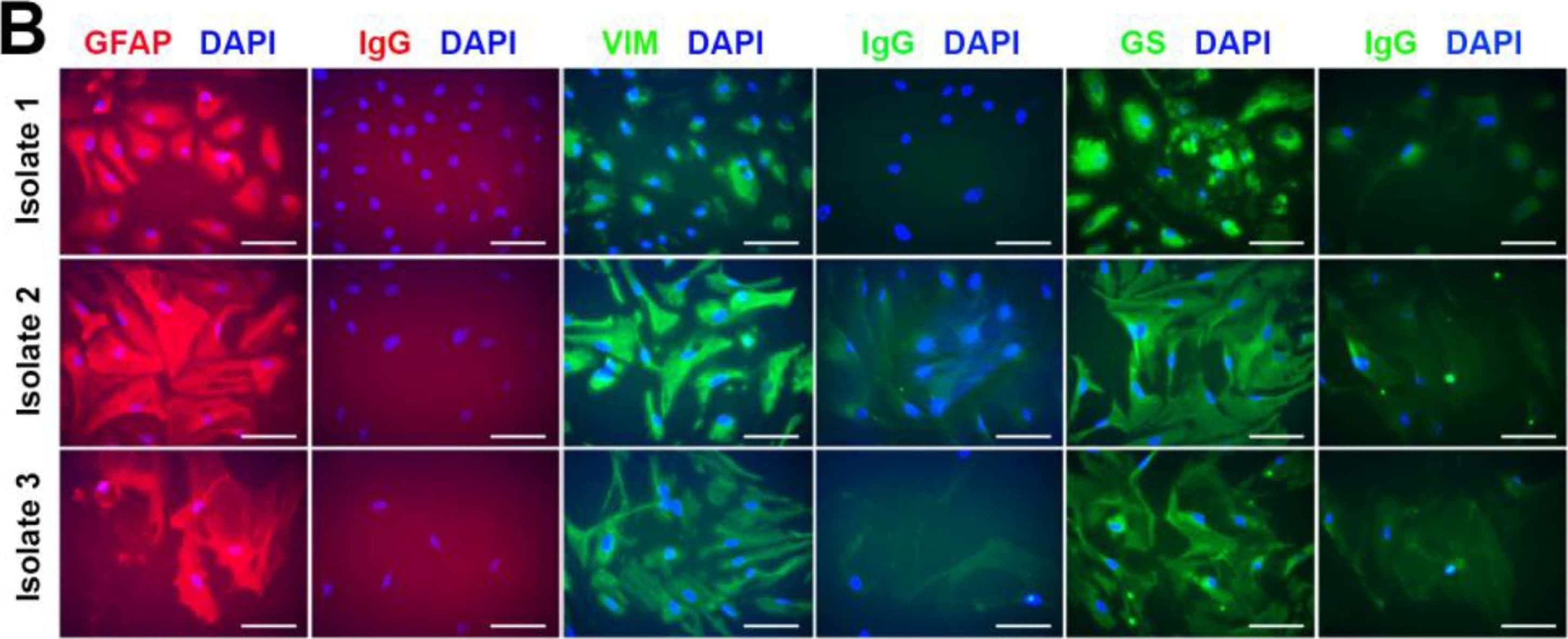 Detection of GFAP by Immunocytochemistry/ Immunofluorescence