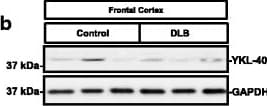 Detection of Human Chitinase 3-like 1 by Western Blot