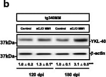 Detection of Human Chitinase 3-like 1 by Western Blot