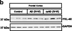Detection of Human Chitinase 3-like 1 by Western Blot