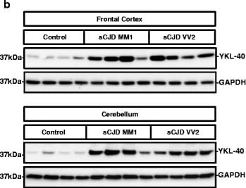 Detection of Human Chitinase 3-like 1 by Western Blot