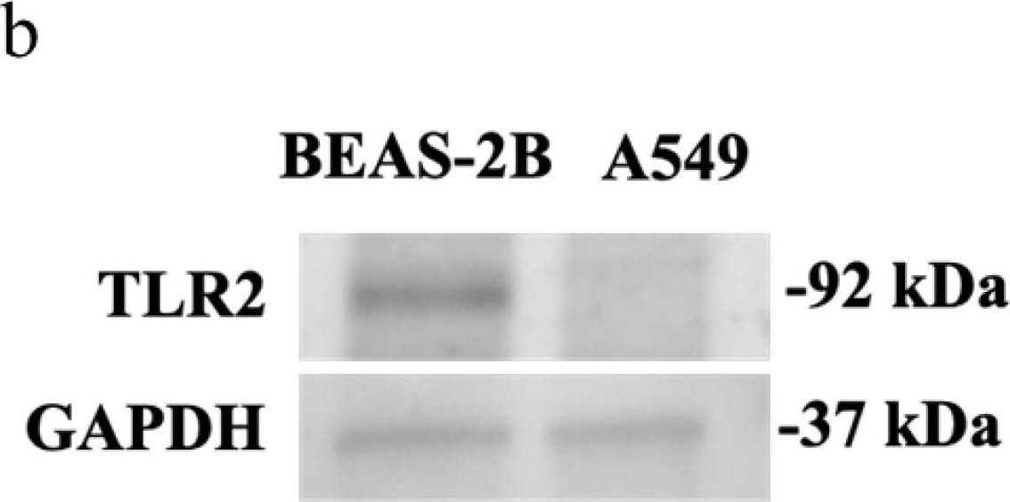 Detection of Human TLR2 by Western Blot