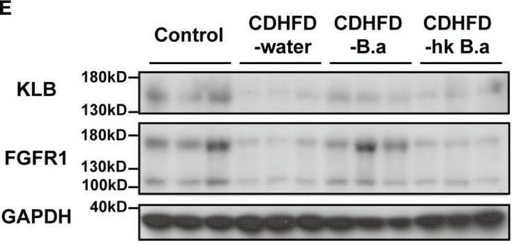 Detection of Klotho  beta  by Western Blot