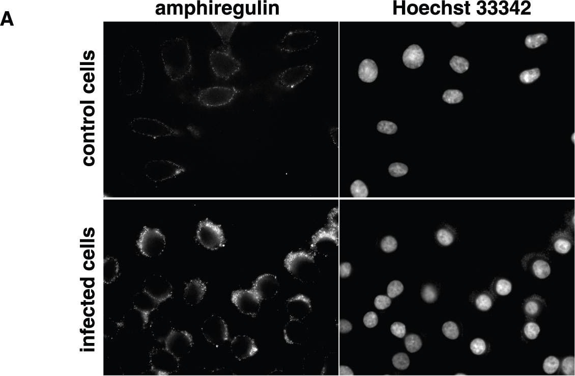 Detection of Amphiregulin by Immunocytochemistry/ Immunofluorescence
