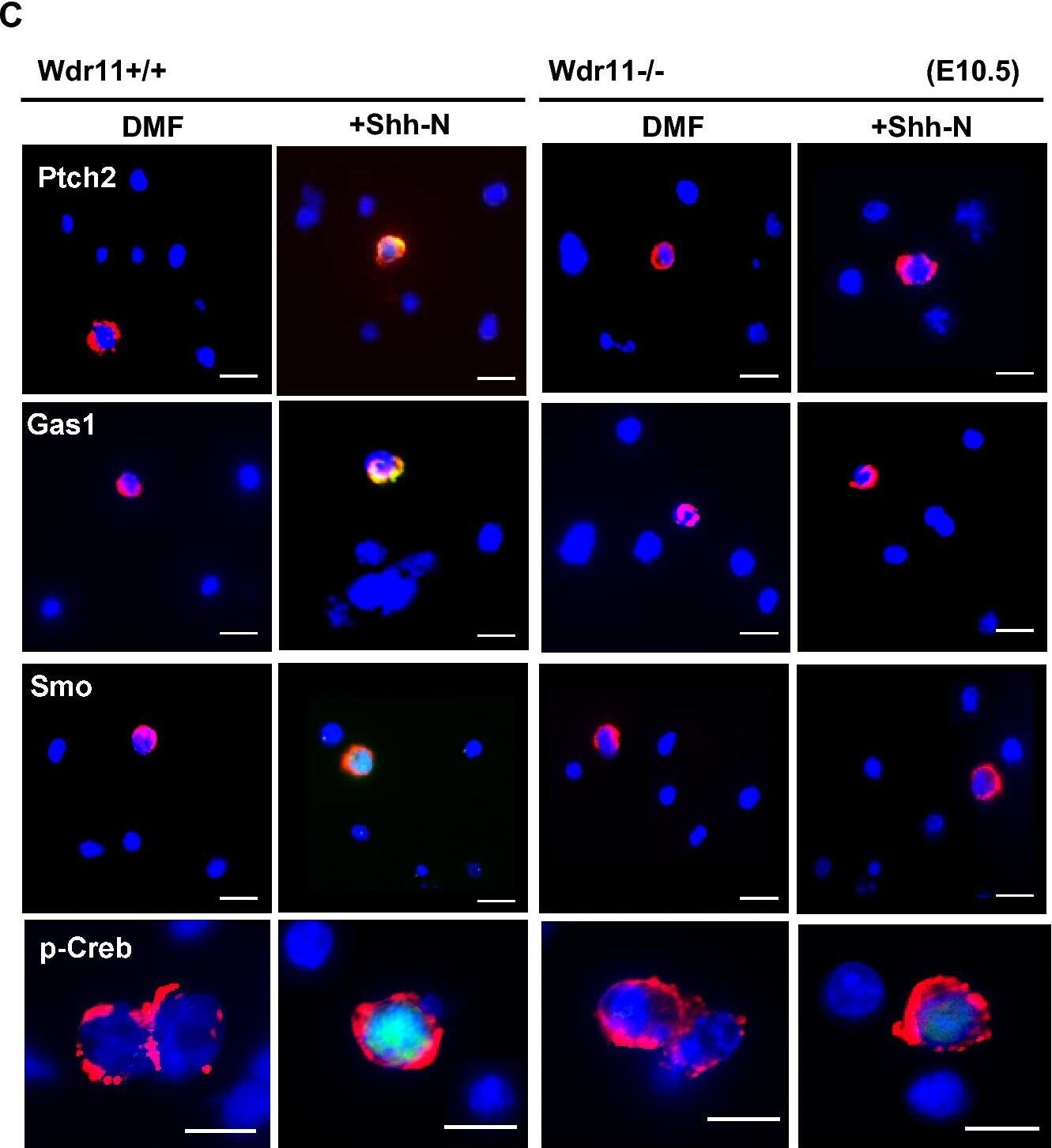 Detection of Gas1 by Immunocytochemistry/ Immunofluorescence