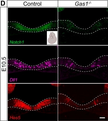 Detection of Gas1 by Immunohistochemistry