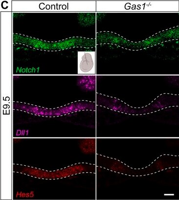 Detection of Gas1 by Immunohistochemistry