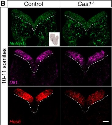 Detection of Gas1 by Immunohistochemistry