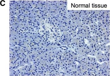 Detection of Human Nectin-4/PVRL4 by Immunocytochemistry/Immunofluorescence