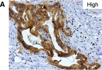 Detection of Human Nectin-4/PVRL4 by Immunocytochemistry/Immunofluorescence