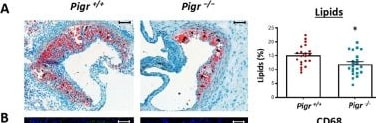 Detection of pIgR by Immunohistochemistry