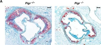 Detection of pIgR by Immunohistochemistry