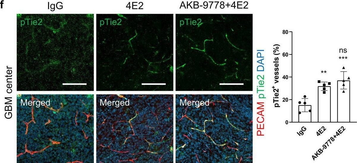 Detection of Phospho-Tie-2 (Y992) by Immunohistochemistry