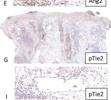 Detection of Phospho-Tie-2 (Y992) by Immunohistochemistry