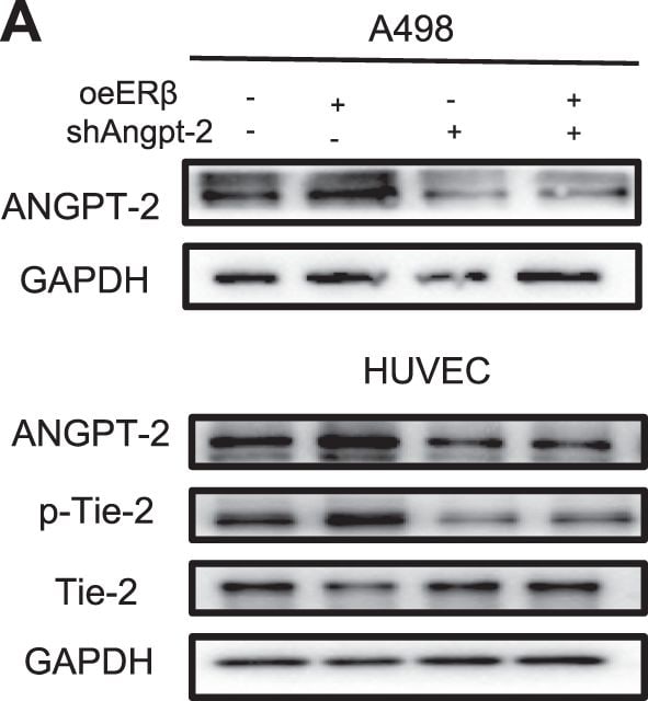 Detection of Phospho-Tie-2 (Y992) by Western Blot