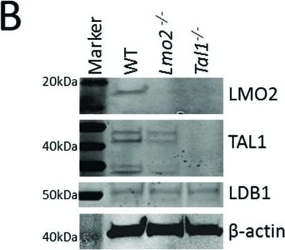 Detection of Mouse LMO2 by Western Blot