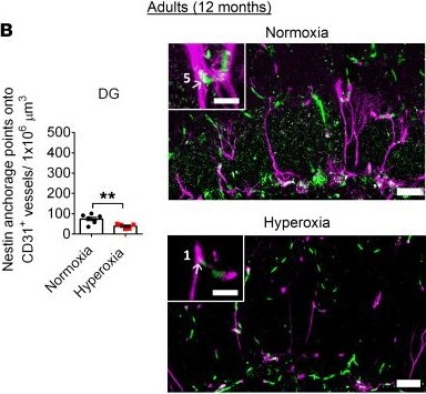 Detection of Nestin by Immunohistochemistry
