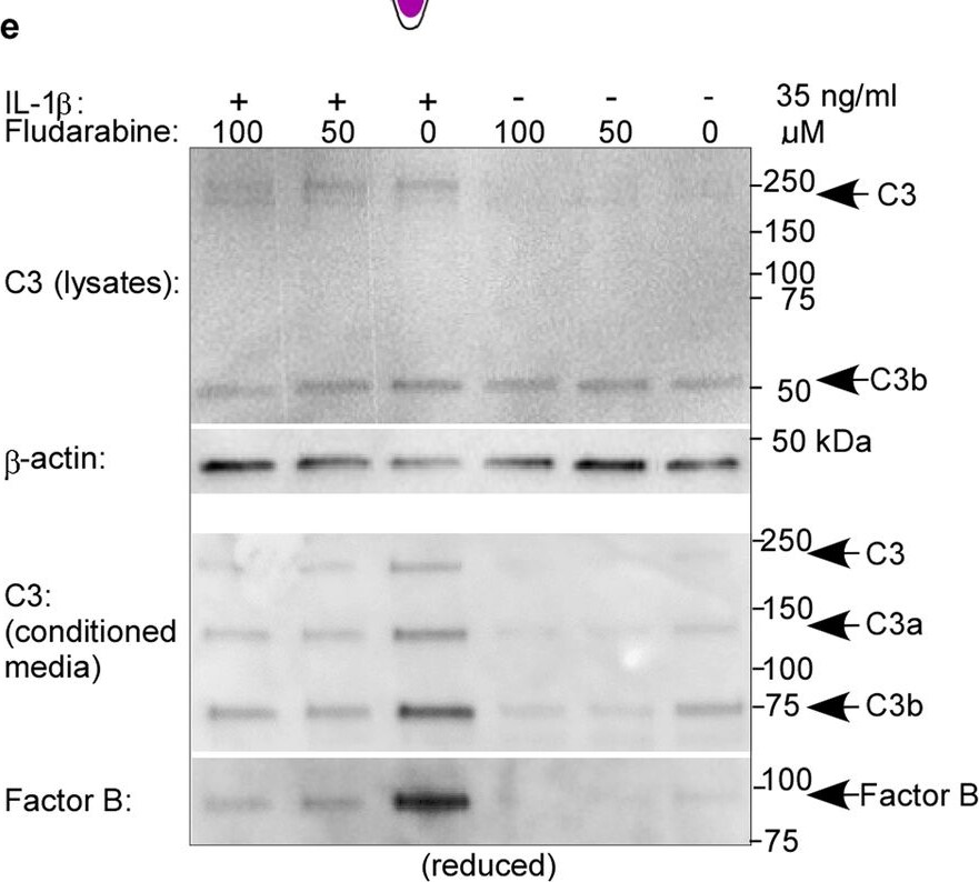 Detection of Complement Factor B by Western Blot