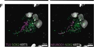 Detection of NeuroD1 by Immunohistochemistry
