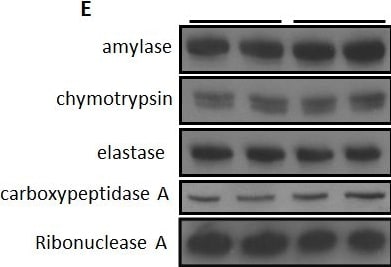 Detection of Carboxypeptidase A1/CPA1 by Western Blot