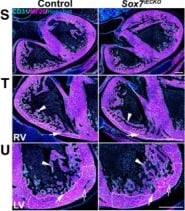 Detection of SOX7 by Immunohistochemistry