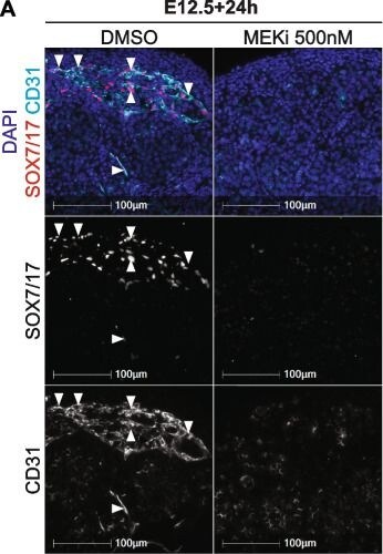 Detection of SOX7 by Immunohistochemistry