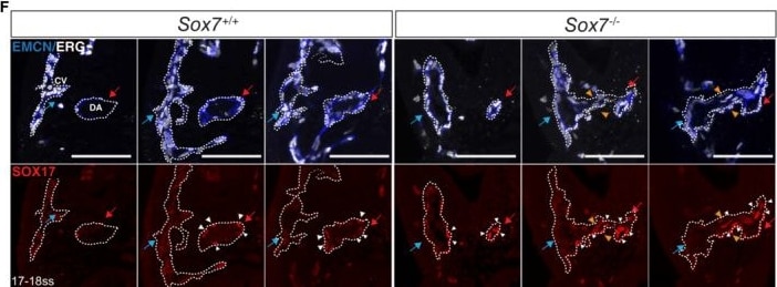Detection of SOX7 by Immunohistochemistry