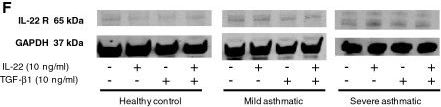 Detection of Human IL-22R alpha 1 by Western Blot