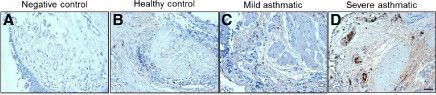 Detection of Human IL-22R alpha 1 by Immunohistochemistry
