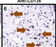 Detection of Syndecan-1 by Immunohistochemistry