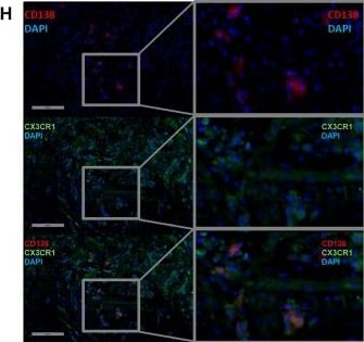 Detection of Syndecan-1 by Immunohistochemistry