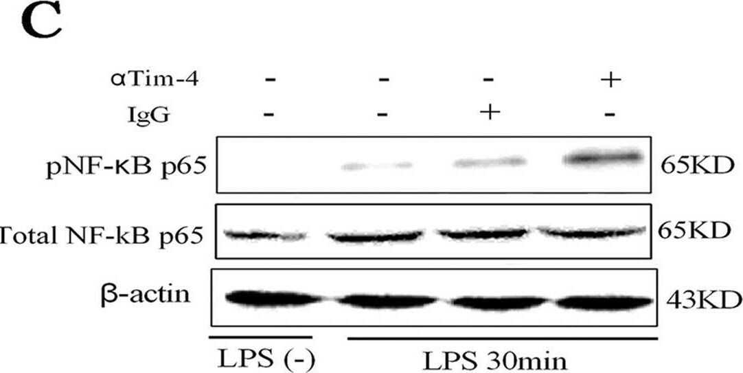 Detection of Mouse TIM-4 by Western Blot