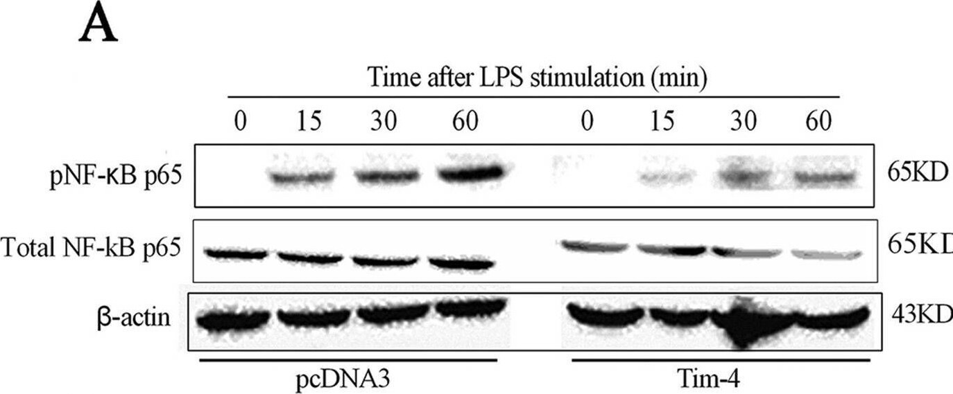 Detection of Mouse TIM-4 by Western Blot