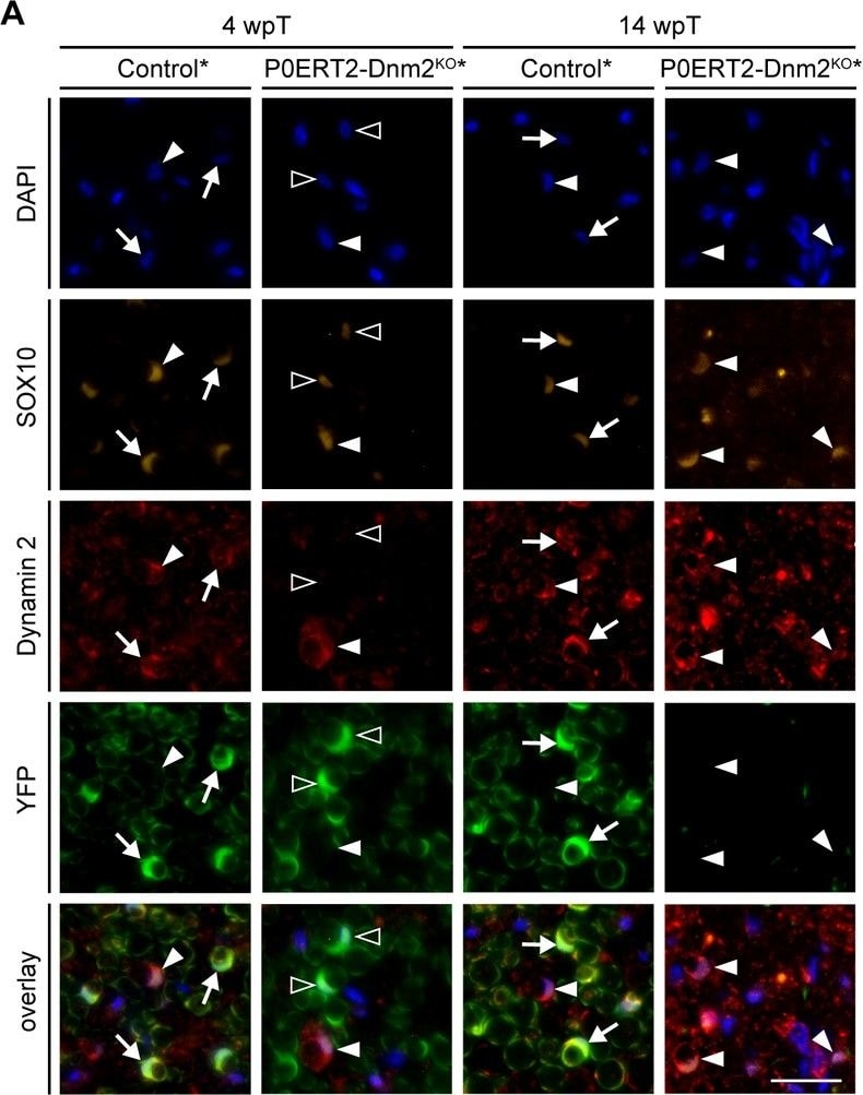 Detection of Mouse SOX10 by Immunocytochemistry/Immunofluorescence