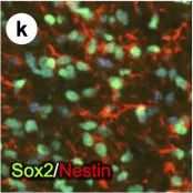Detection of Mouse SOX10 by Immunohistochemistry