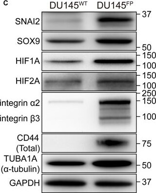 Detection of Human HIF-2 alpha/EPAS1 by Western Blot